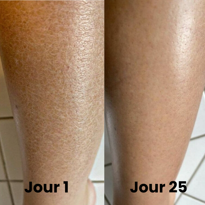 Step 2: Customize Options